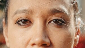 Blépharoplastie : un regard frais et reposé