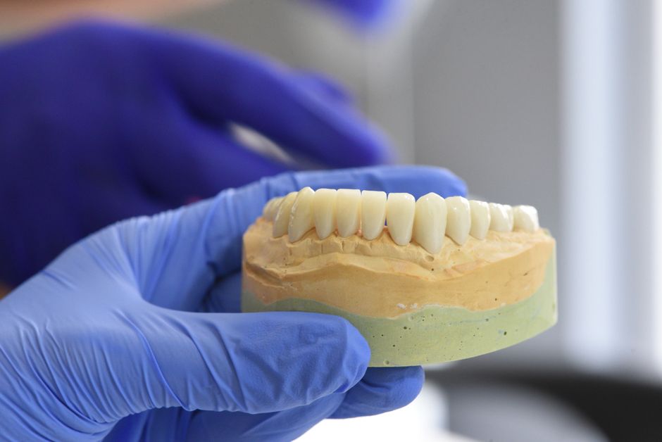 Smiling patient with dental crown in Tunisia clinic