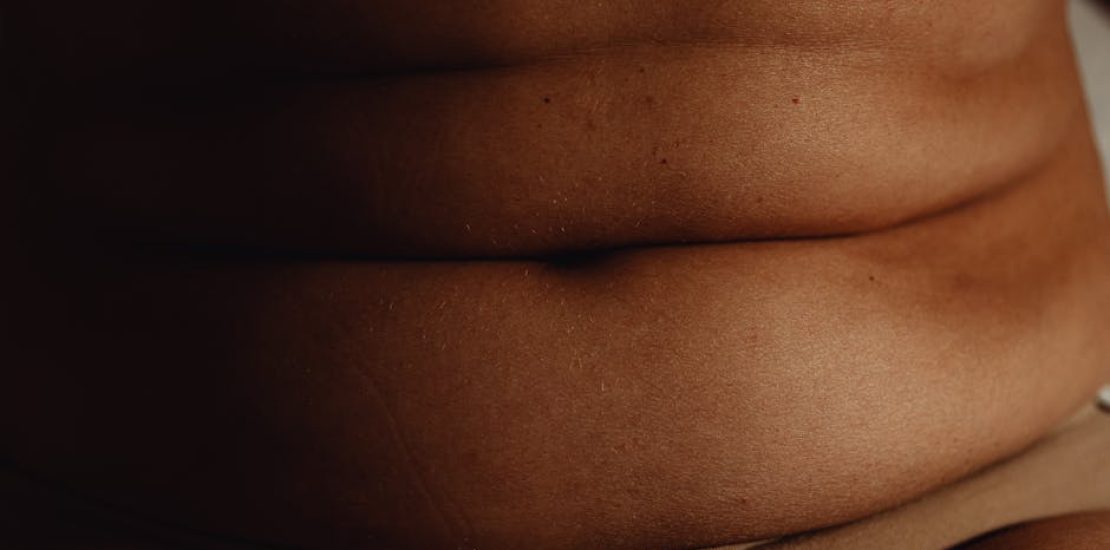 abdominoplastie-tunisie-prix-avis.jpg