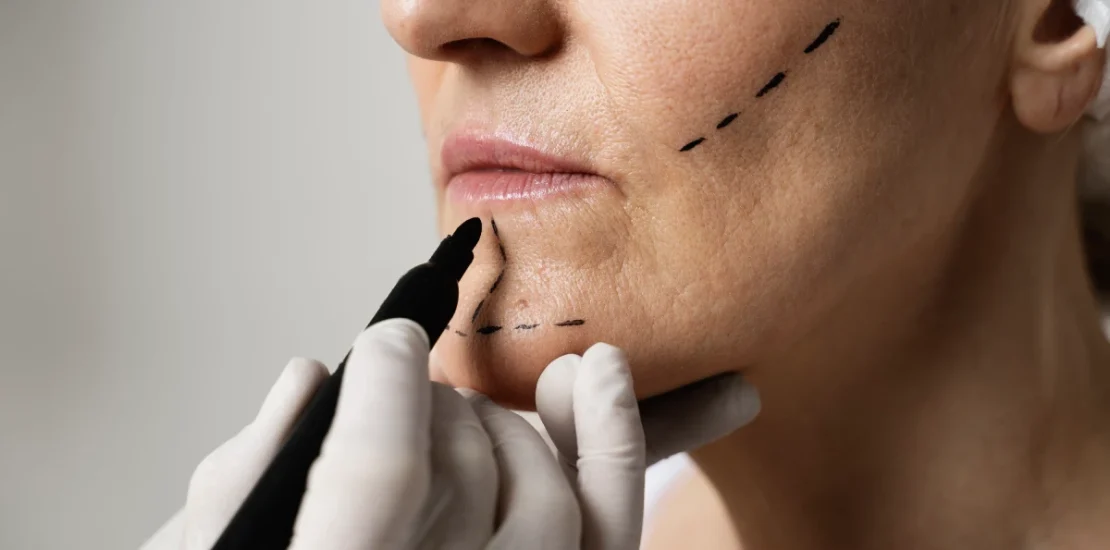 Chirurgie esthétique