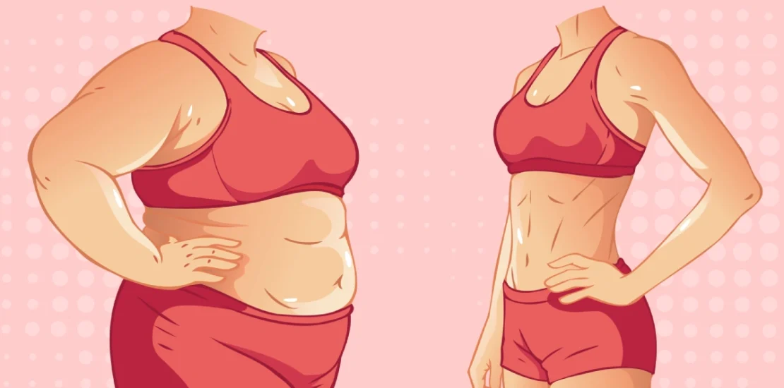 Chirurgie réparatrice post-obésité