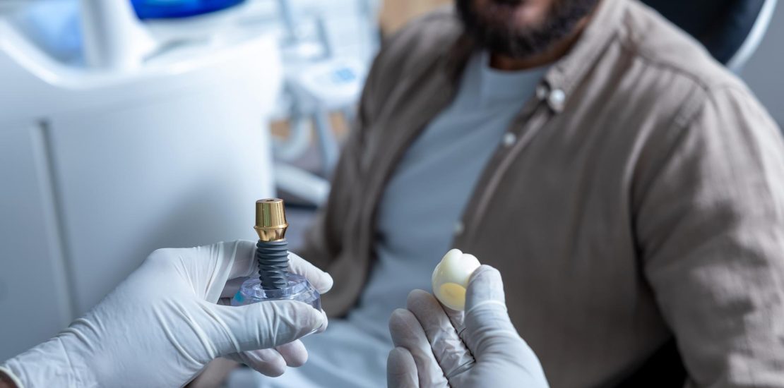 dental-implants-tunisia-price-2026.jpg