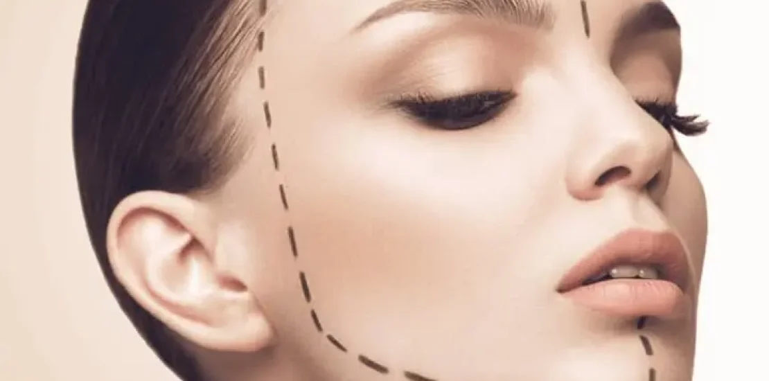 Génioplastie Tunisie chirurgie esthétique du visage