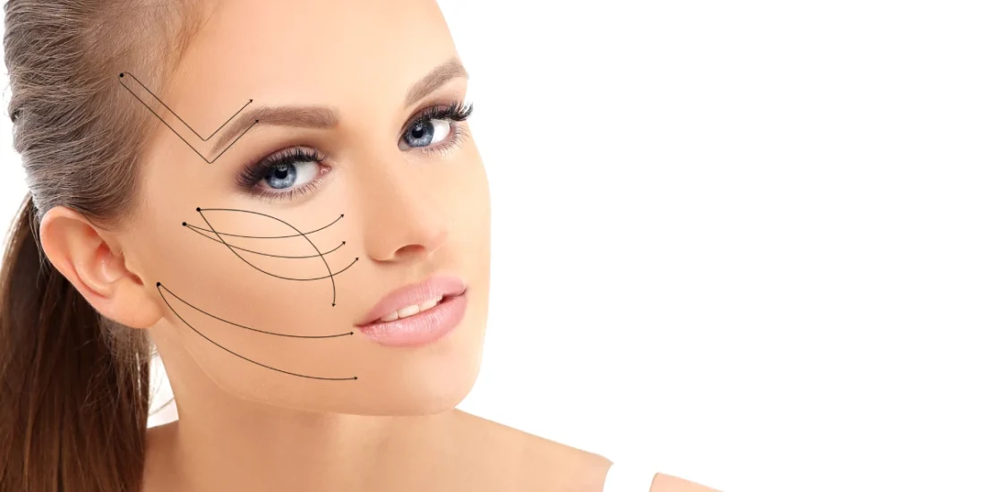 Le lifting endoscopique