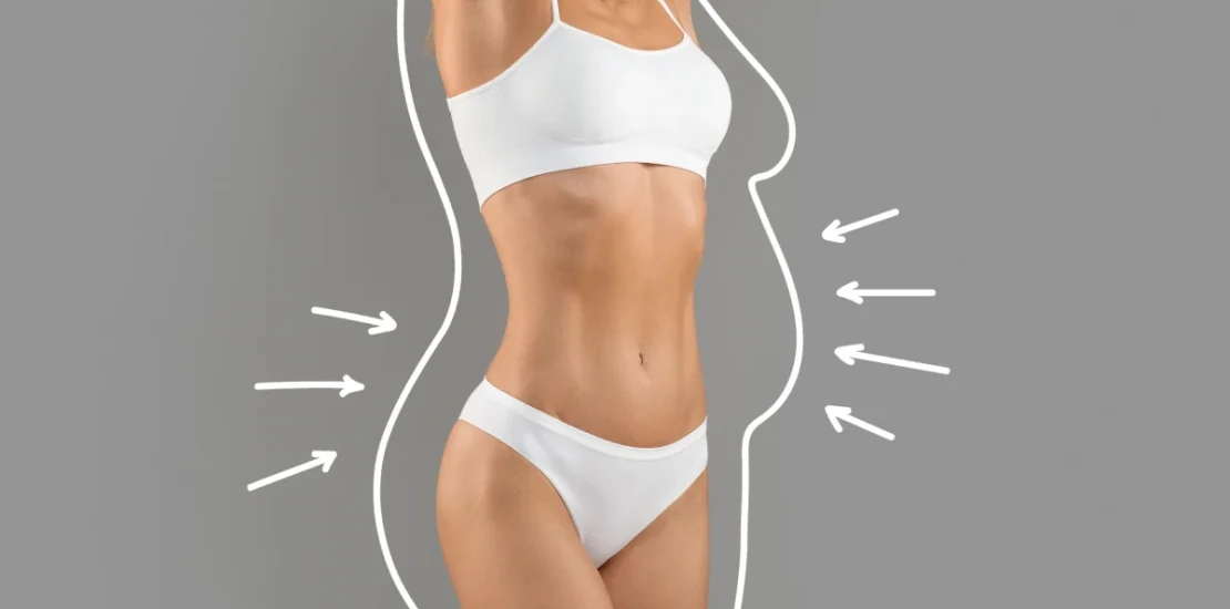 Liposculpture avant après