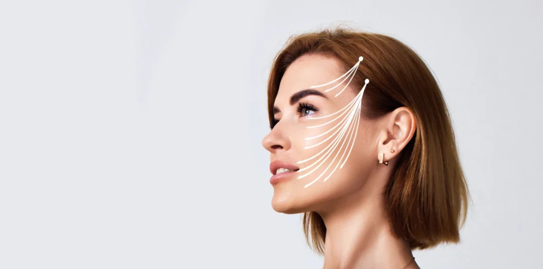 Mini lifting facial