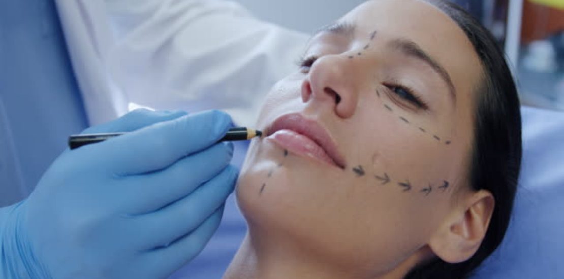Side view close up of a Caucasian female patient lying on the operating table at a clinic while a cosmetic surgeon makes marks on her face with a pencil, slow motion