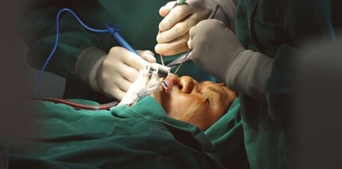 plastic-surgery-tunisia-avant-apres.jpg