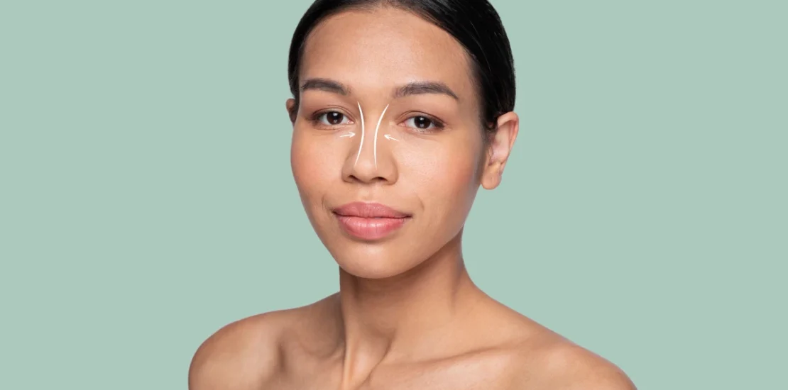 Questions avant une rhinoplastie